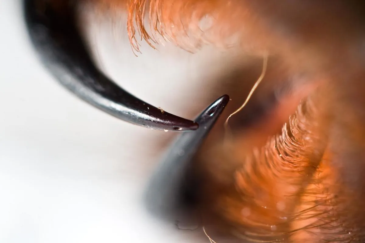 19088 medical attention spider bites